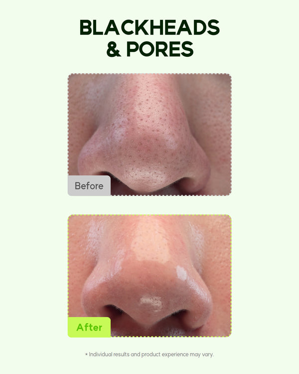 Orien Melting Sebum Cleansing Oil 1+1 Set