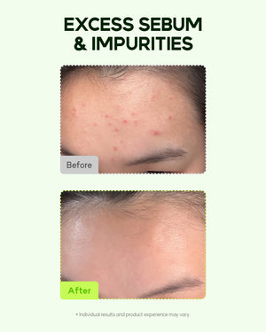 Orien Mugwort Zero Film Cleansing Foam 150ml