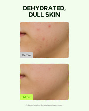 Orien Mugwort Zero Film Toner 160ml