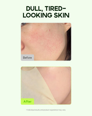 Orien Vitamin C Serum Mask (4 Sheets)