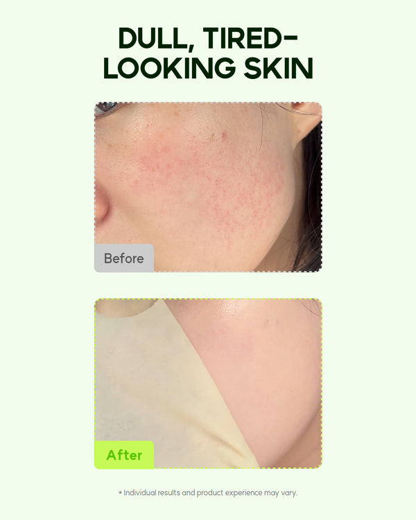 Orien Vitamin C Serum Mask (4 Sheets)